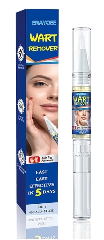 Wart Remover